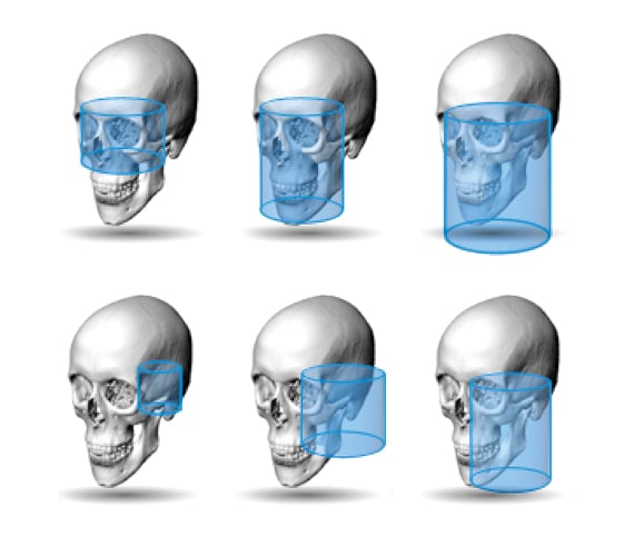 プランメカ ProMax® 3D Plus | Planmeca Japan